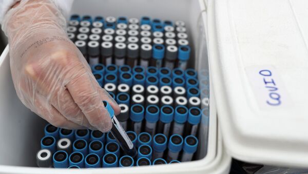 Unas muestras de sangre para tests de COVID-19 en Brasil (archivo) - Sputnik Mundo