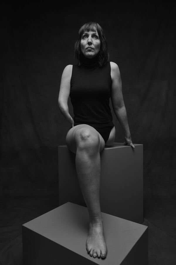 No tengo más que perder: víctimas del fármaco talidomida en España luchan por su resarcimiento - Sputnik Mundo