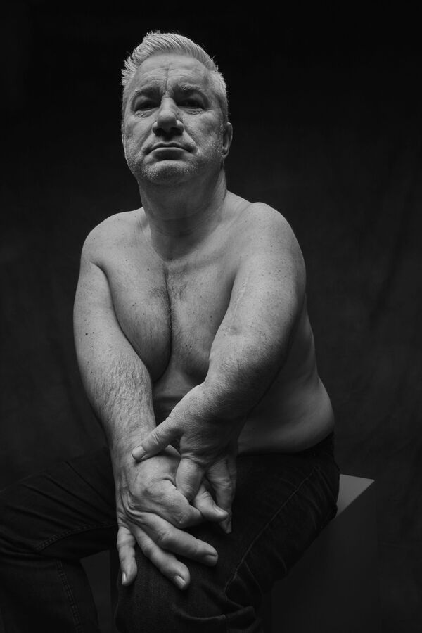 No tengo más que perder: víctimas del fármaco talidomida en España luchan por su resarcimiento - Sputnik Mundo