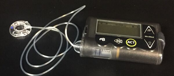 Bomba de insulina - Sputnik Mundo