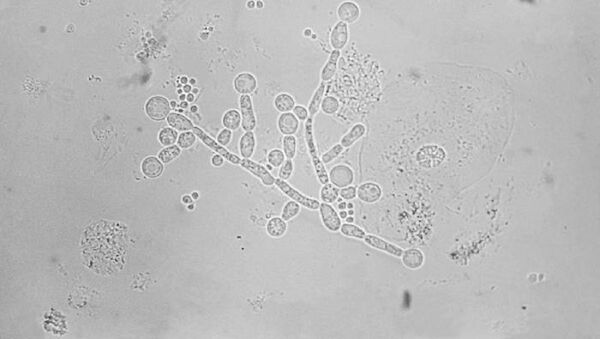 Candida albicans - Sputnik Mundo