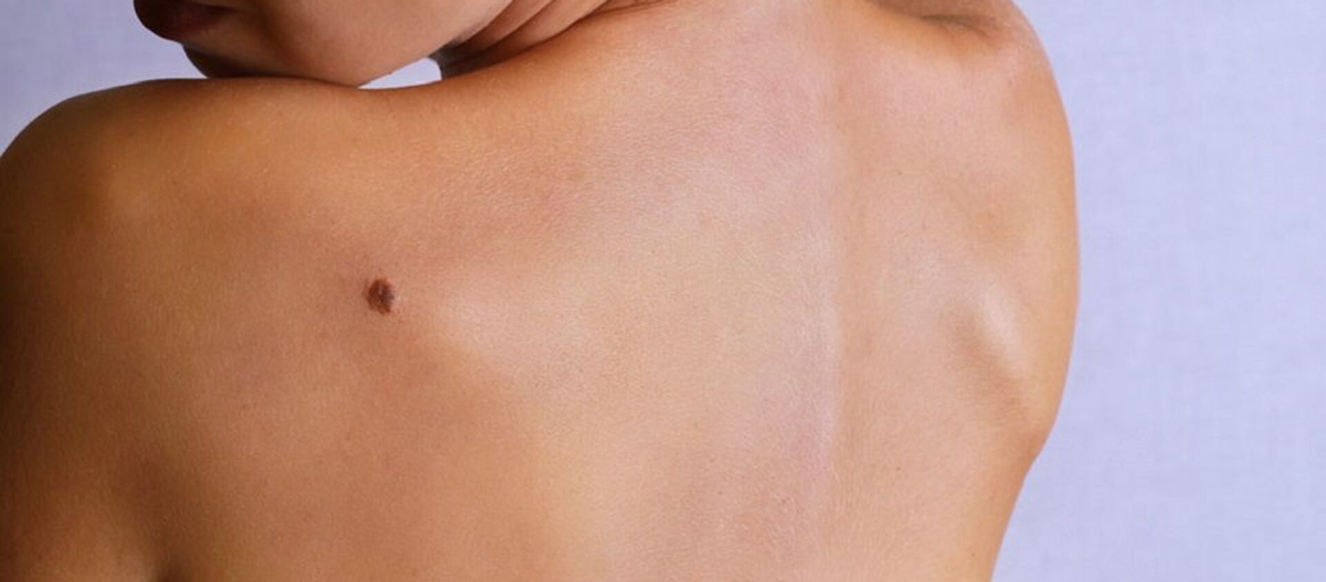 Una mujer con lunar en el hombro - Sputnik Mundo, 1920, 07.09.2020