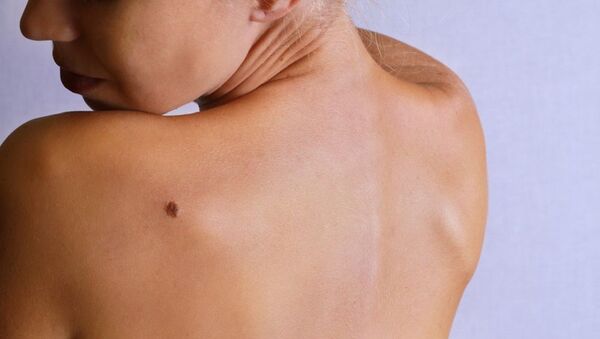 Una mujer con lunar en el hombro - Sputnik Mundo