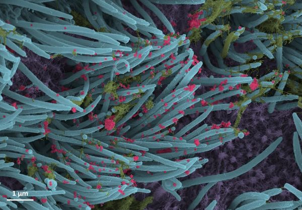 Así se ve el coronavirus en las células bronquiales humanas Así se ve el coronavirus en las células bronquiales humanas - Sputnik Mundo