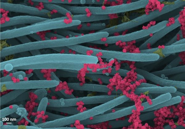 Así se ve el coronavirus en las células bronquiales humanas Así se ve el coronavirus en las células bronquiales humanas - Sputnik Mundo