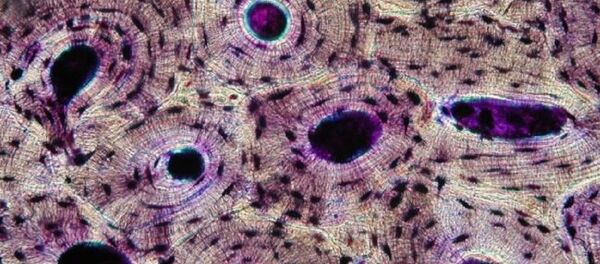 Tejido óseo (imagen referencial) - Sputnik Mundo