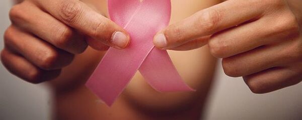Día internacional del cáncer de mama (referencial) - Sputnik Mundo