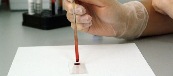 Una análisis de sangre, referencial - Sputnik Mundo