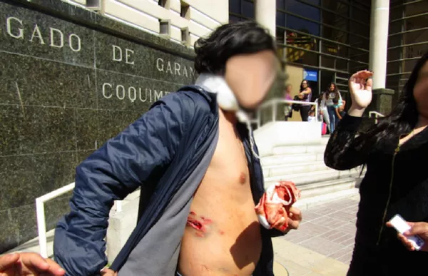 Pareja chilena violentada por Carabineros pide asilo en Canadá Pareja chilena violentada por Carabineros pide asilo en Canadá - Sputnik Mundo