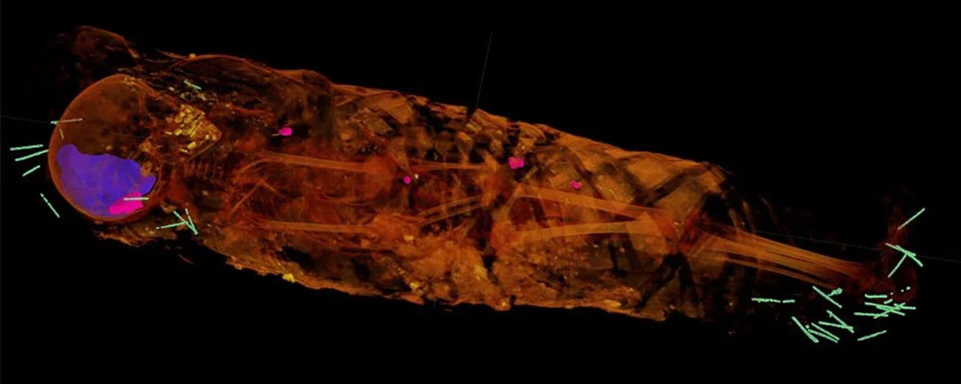 Una imágen de rayos X de la Momia de retrato número 4 de Hawara - Sputnik Mundo, 1920, 28.11.2020