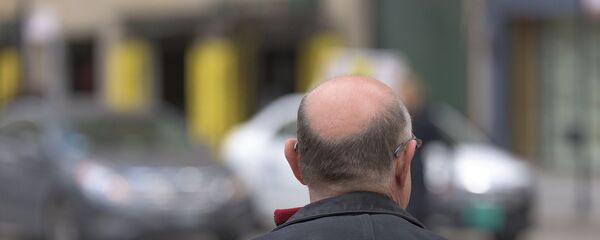 Un hombre con alopecia, imagen ilustrativa - Sputnik Mundo