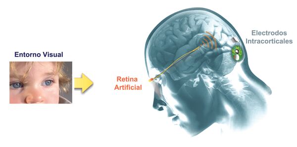 Esquema de la neuroprótesis del experimento Esquema de la neuroprótesis del experimento - Sputnik Mundo