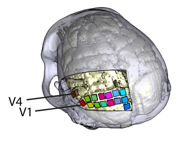 Localización de las matrices en la corteza visual del cerebro de los primates durante el experimento Localización de las matrices en la corteza visual del cerebro de los primates durante el experimento - Sputnik Mundo