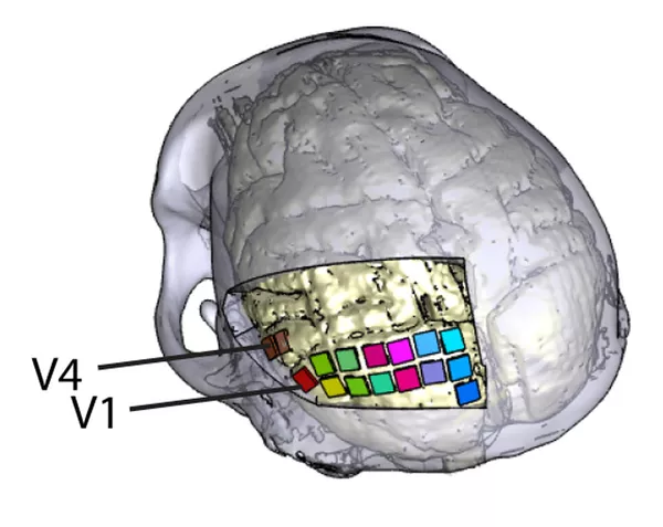 Localización de las matrices en la corteza visual del cerebro de los primates durante el experimento Localización de las matrices en la corteza visual del cerebro de los primates durante el experimento - Sputnik Mundo