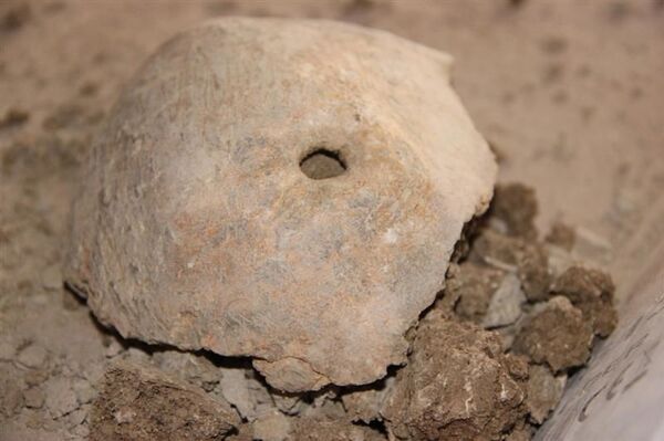 Cráneo con un agujero provocado por una cirugía (Tauste) - Sputnik Mundo