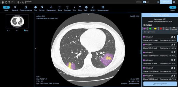 Imagen tomográfica del sistema de inteligencia artificial Botkin.AI - Sputnik Mundo