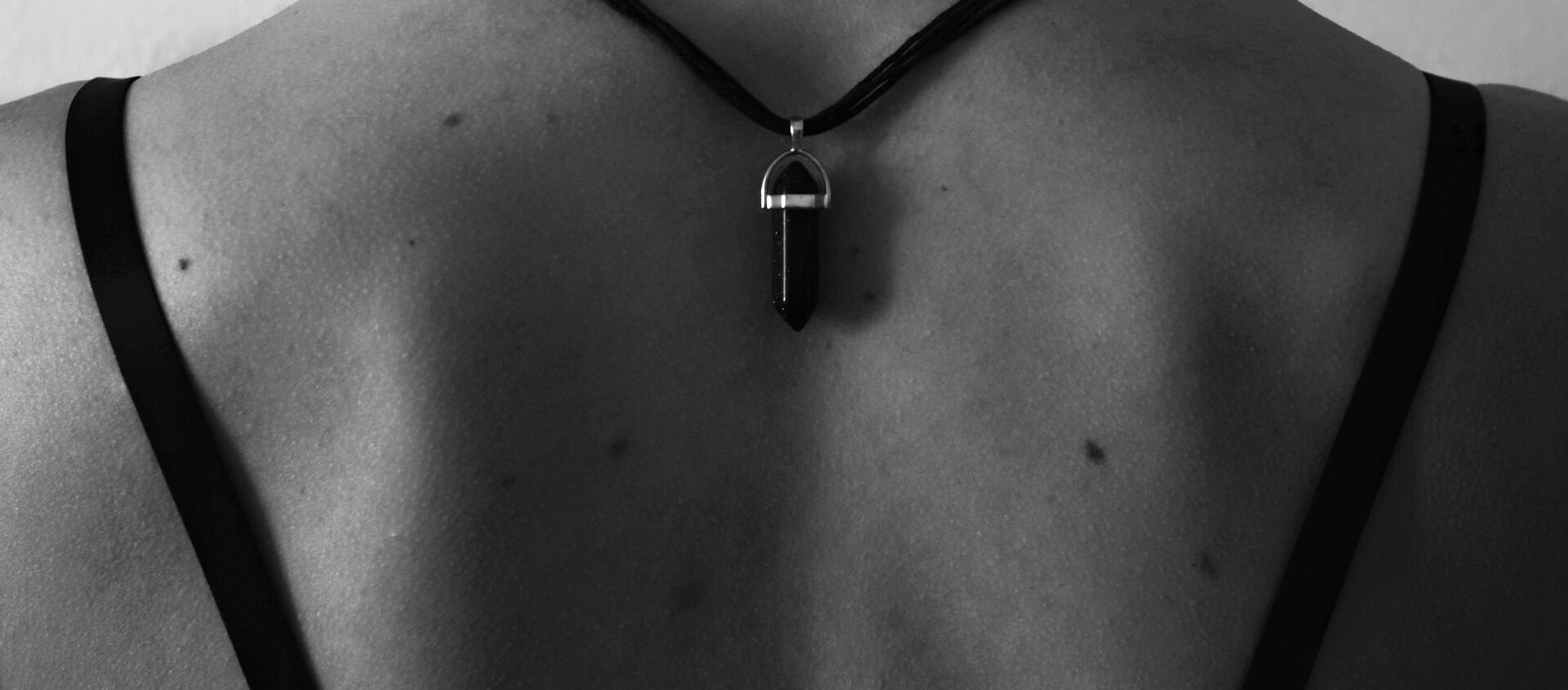 Unos lunares en el cuerpo - Sputnik Mundo, 1920, 03.02.2021