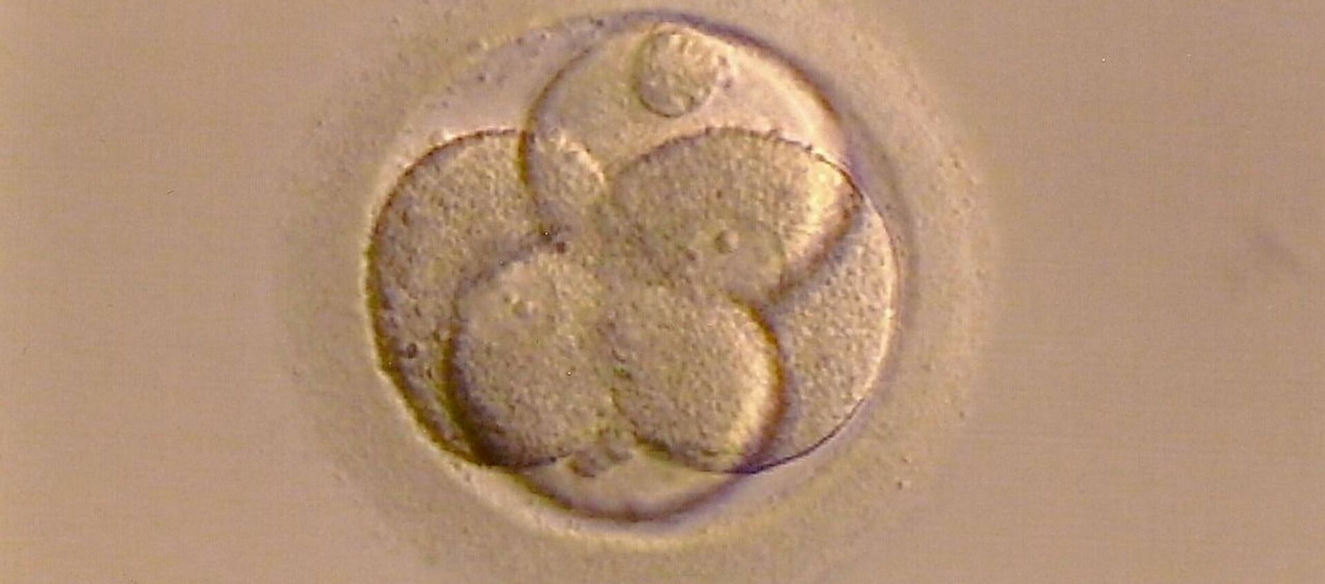 Un óvulo fecundado (imagen referencial) - Sputnik Mundo, 1920, 05.02.2021