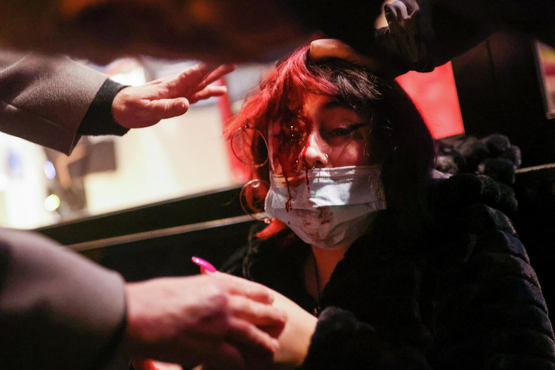 Mujer herida durante los disturbios en Barcelona por la detención del rapero Pablo Hasél - Sputnik Mundo, 1920, 16.02.2021