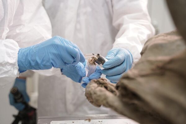 La toma de muestras de tejidos blandos - Sputnik Mundo