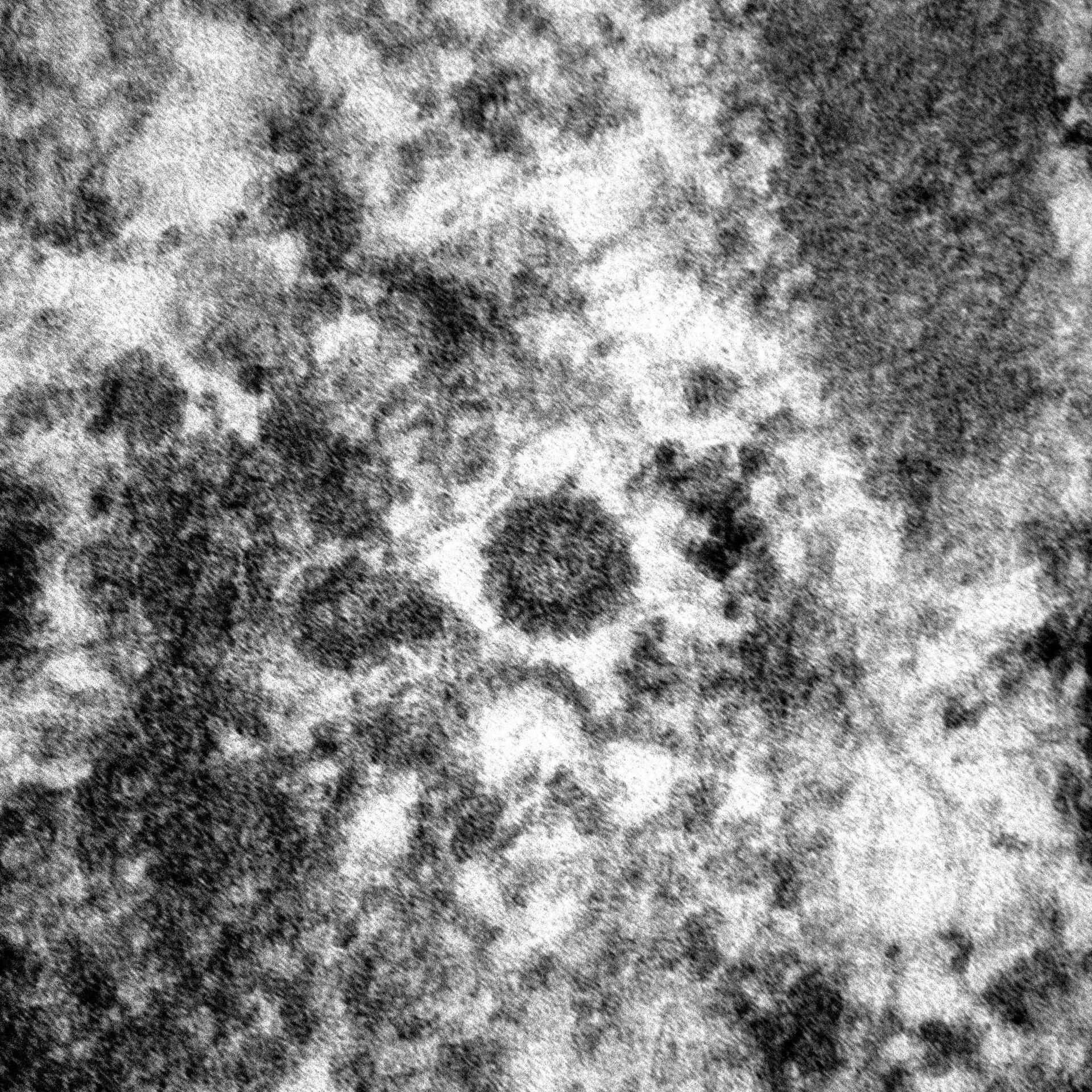 Así es el coronavirus ampliado dentro del organismo - Sputnik Mundo, 1920, 29.04.2021