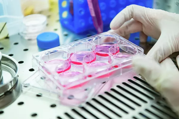 Sustancias en el Laboratorio de Investigación de Biofísica de la NUST MISIS Sustancias en el Laboratorio de Investigación de Biofísica de la NUST MISIS - Sputnik Mundo