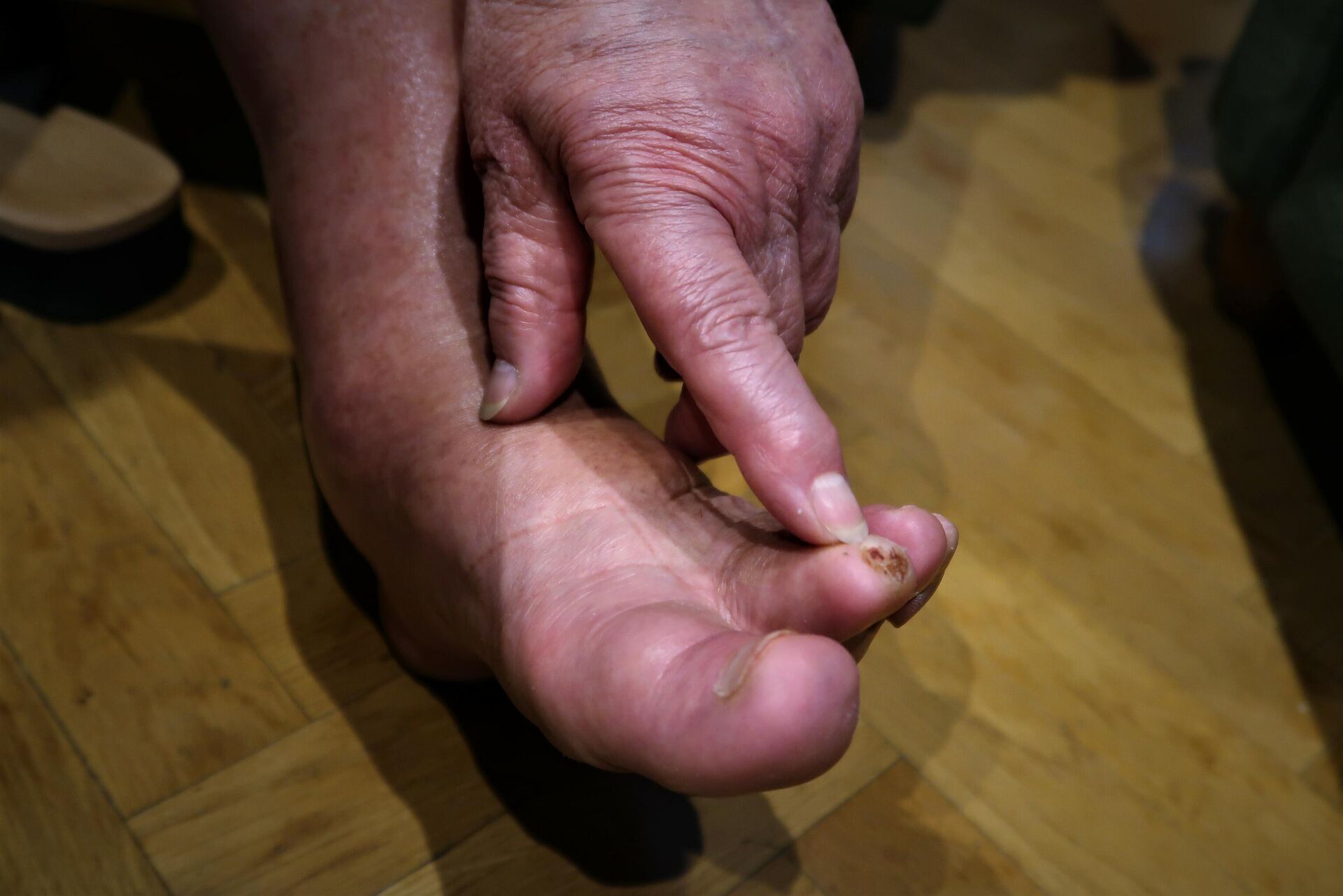 Secuelas producidas por el atentado que sufrió Carmen Anguita, víctima de terrorismo en España Secuelas producidas por el atentado que sufrió Carmen Anguita, víctima de terrorismo en España - Sputnik Mundo, 1920, 01.06.2021