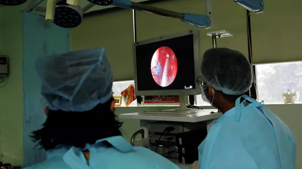 Endoscopia de un paciente con hongo negro  - Sputnik Mundo