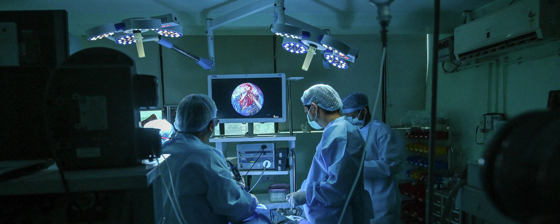 Endoscopia de un paciente con hongo negro  - Sputnik Mundo, 1920, 20.06.2021