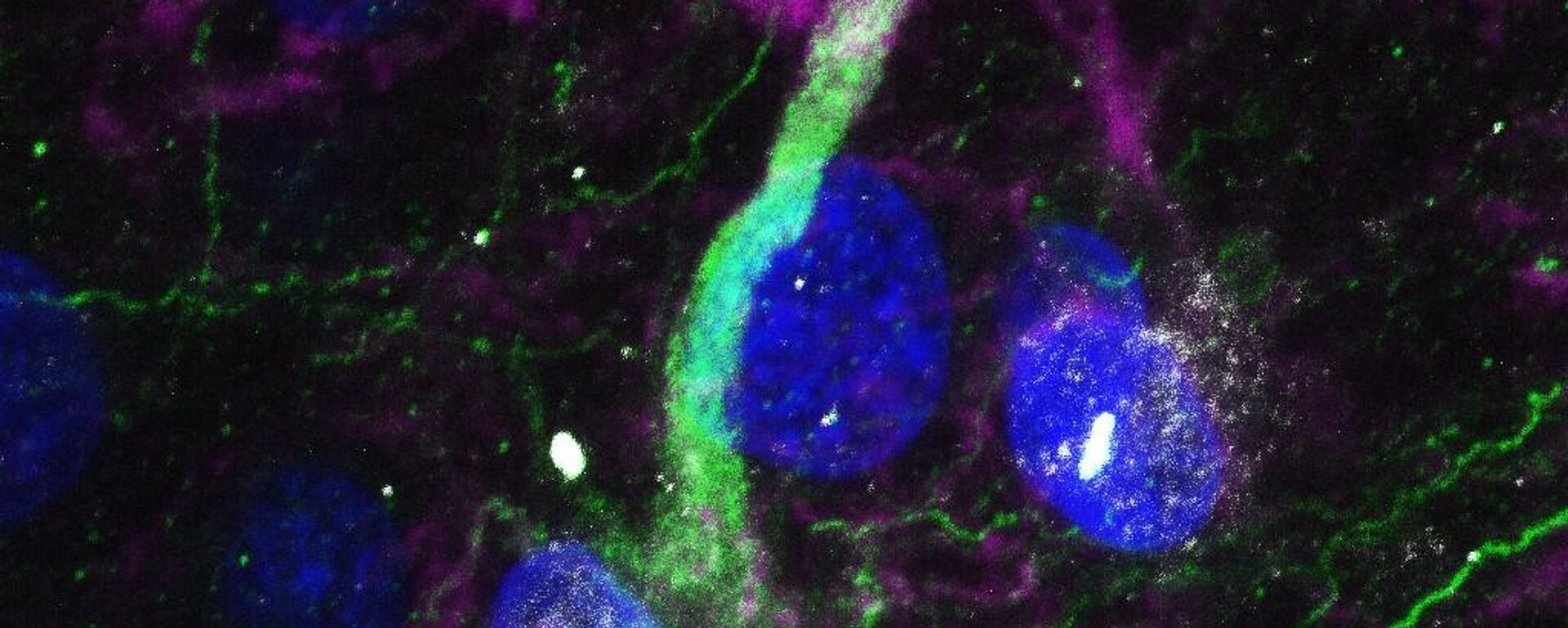 Célula madre en el hipocampo humano adulto - Sputnik Mundo, 1920, 22.10.2021