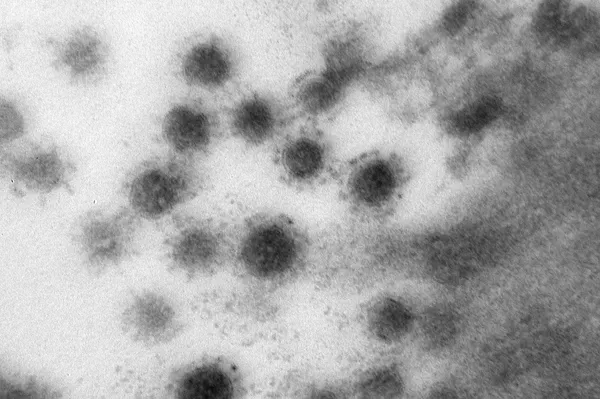 Imagen tomada con un microscopio de la cepa delta del SARS-CoV-2 - Sputnik Mundo