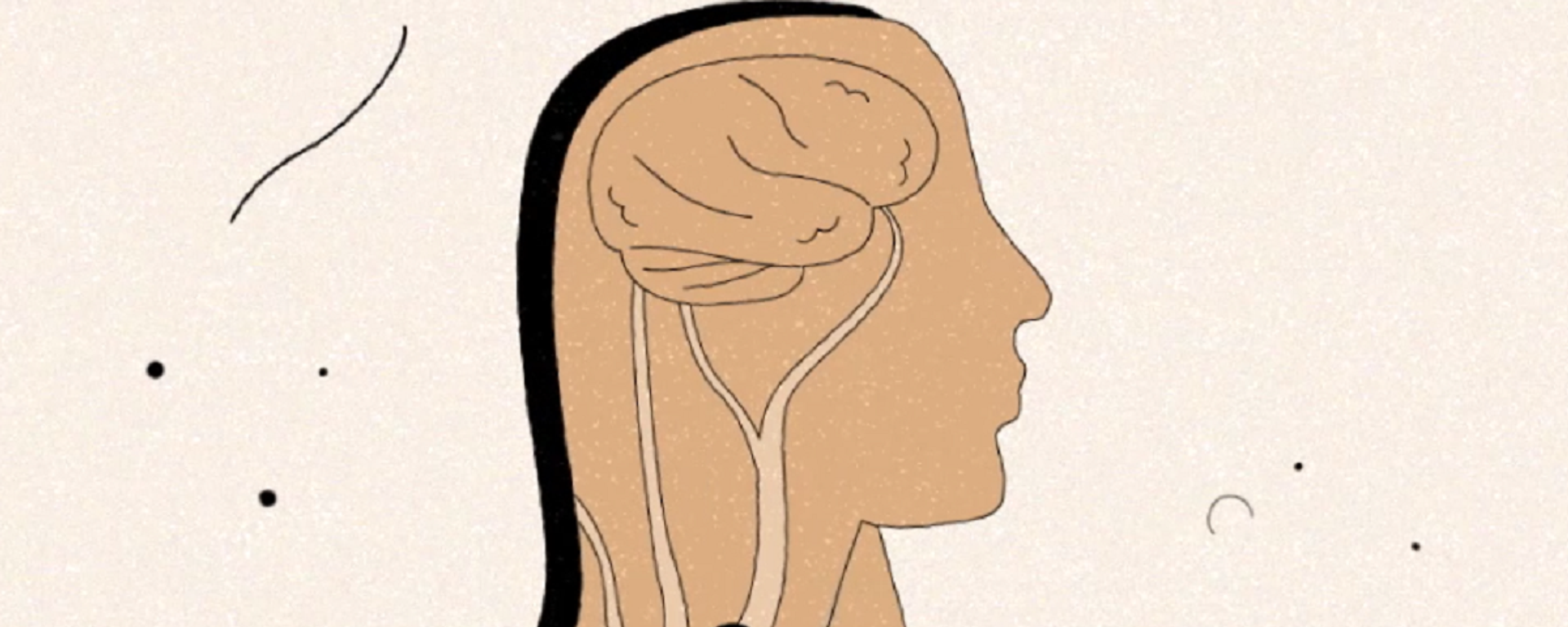 Cómo detectar a tiempo un posible derrame cerebral - Sputnik Mundo, 1920, 29.10.2021