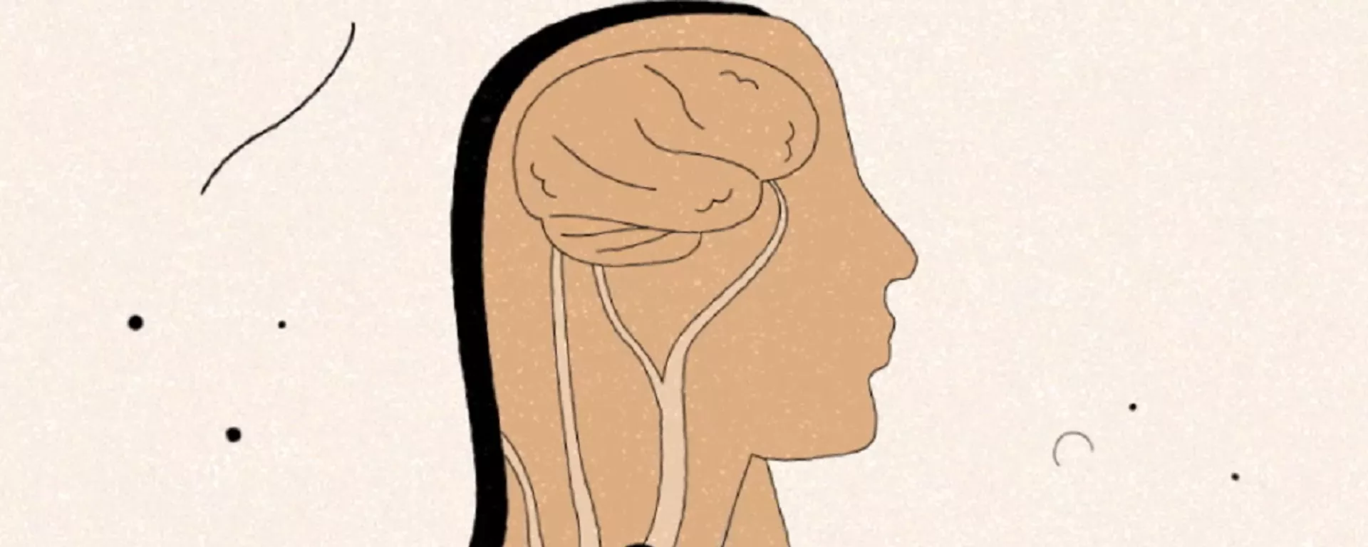 Cómo detectar a tiempo un posible derrame cerebral Cómo detectar a tiempo un posible derrame cerebral - Sputnik Mundo, 1920, 29.10.2021
