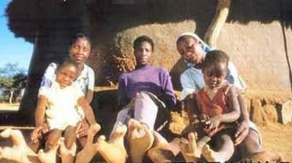 Familia con ectrodactilia, perteneciente a la tribu de los vadoma. - Sputnik Mundo