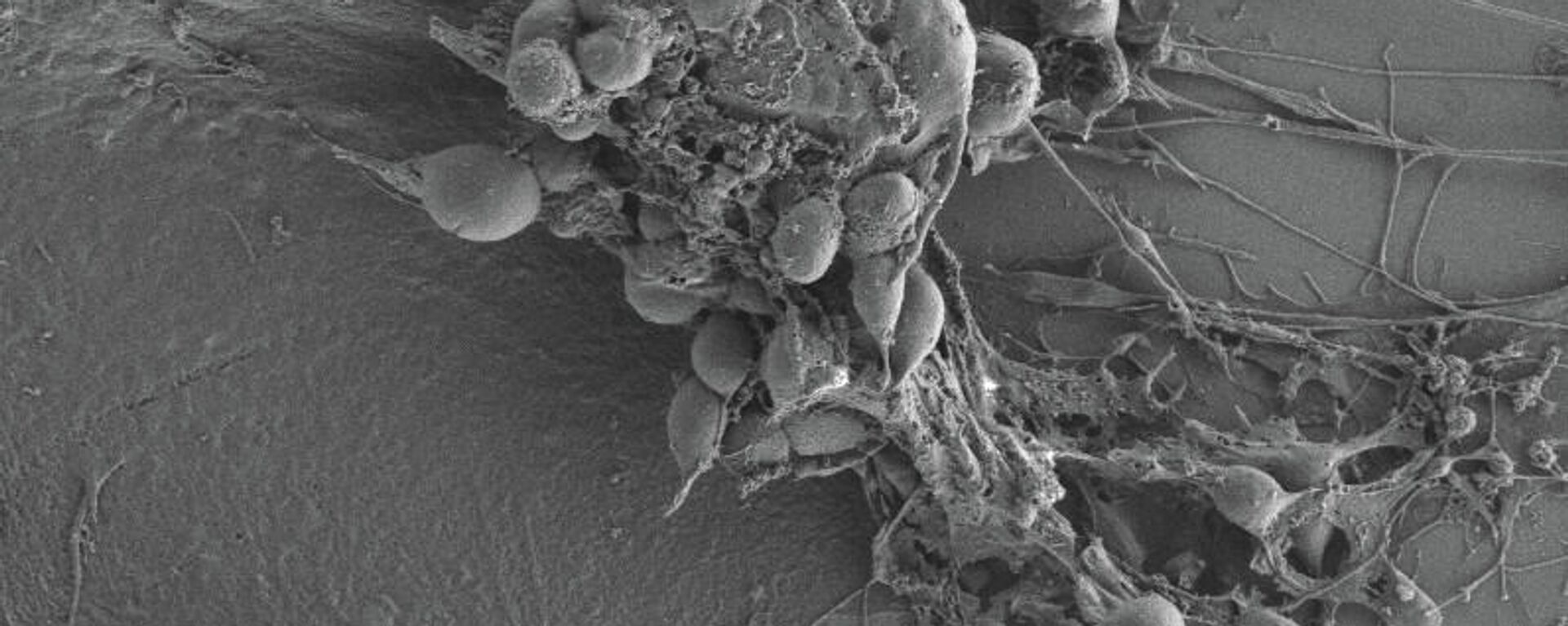 Célula de glioblastoma humano tratada con gosipol y vista con la técnica de microscopía electrónica de escaneo de emisión de campo, a partir de muestras obtenidas por fractura por congelación.  - Sputnik Mundo, 1920, 07.11.2024