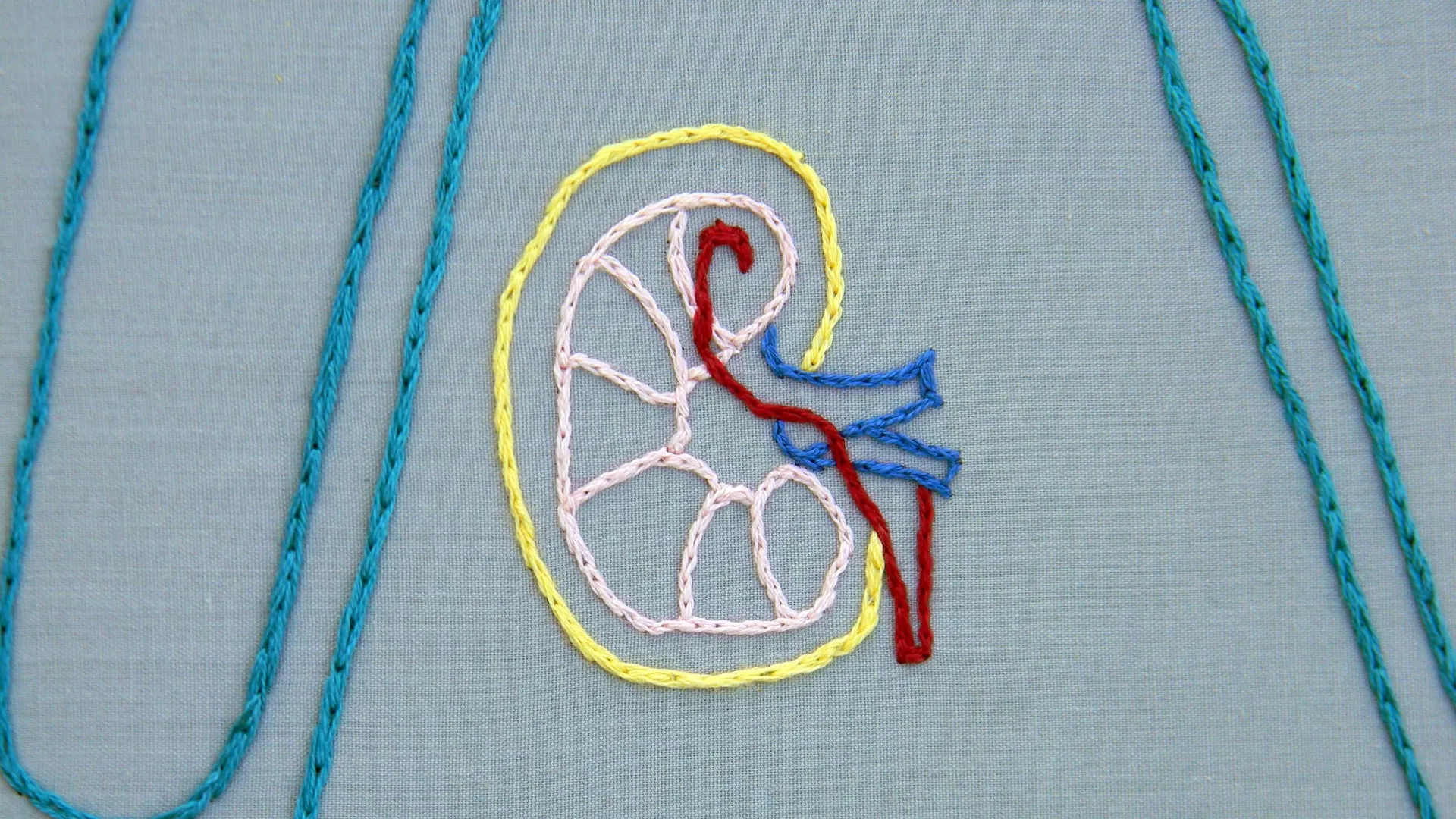 Un riñon