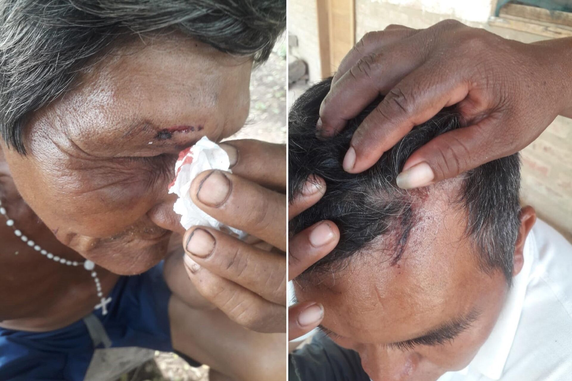 Comunarios del pueblo ayoreo heridos  - Sputnik Mundo, 1920, 06.01.2022