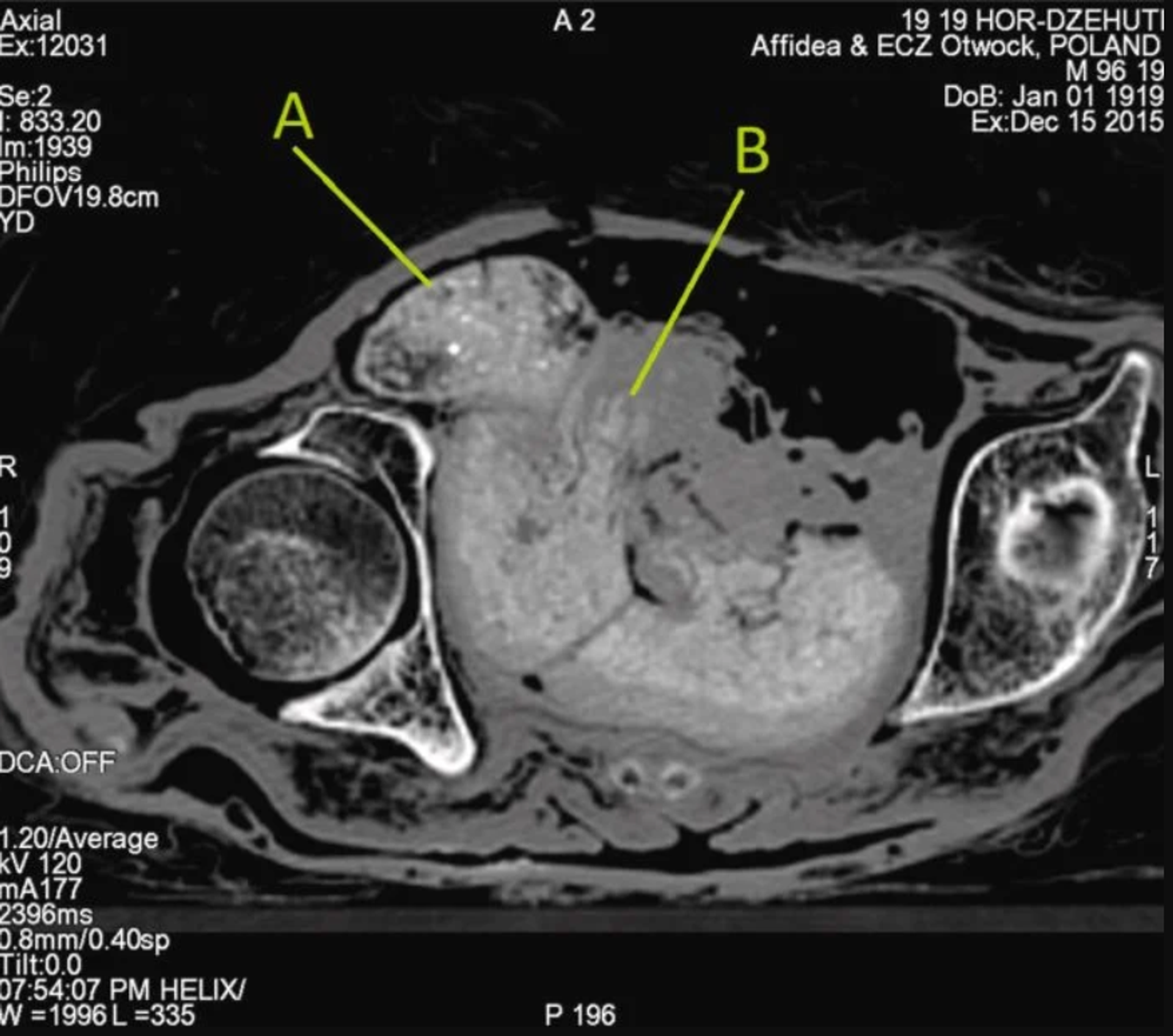 Imagen del feto momificado - Sputnik Mundo, 1920, 26.01.2022