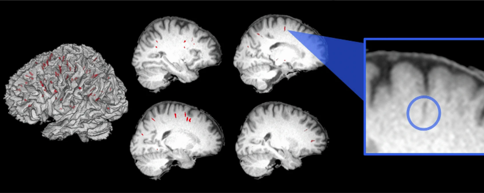 Efectos que tienen las estadías en el espacio sobre el cerebro humano - Sputnik Mundo, 1920, 08.05.2022