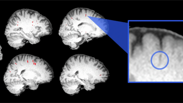 Efectos que tienen las estadías en el espacio sobre el cerebro humano - Sputnik Mundo