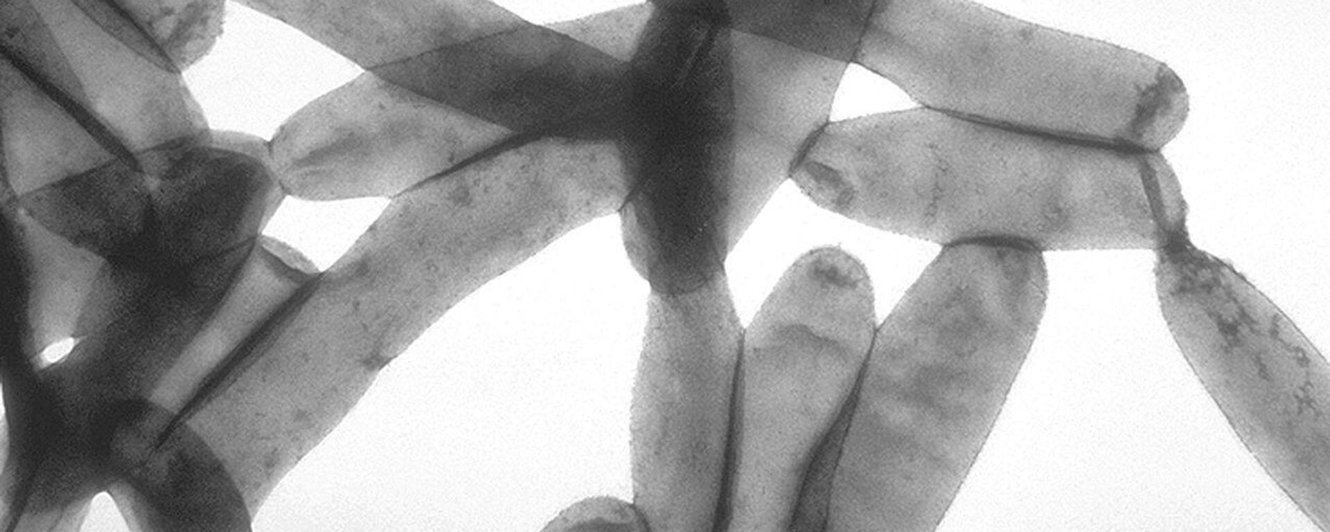 Bacteria 'Legionella pneumophila' - Sputnik Mundo, 1920, 05.09.2022