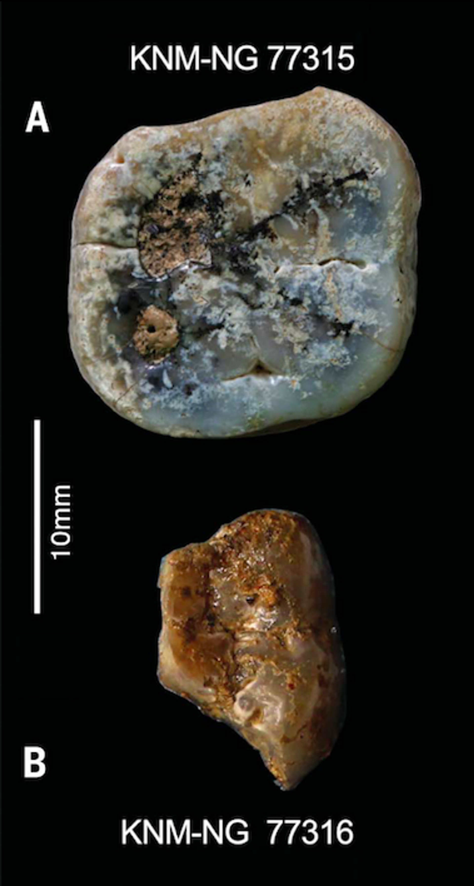 Dos dientes molares - Sputnik Mundo, 1920, 13.02.2023