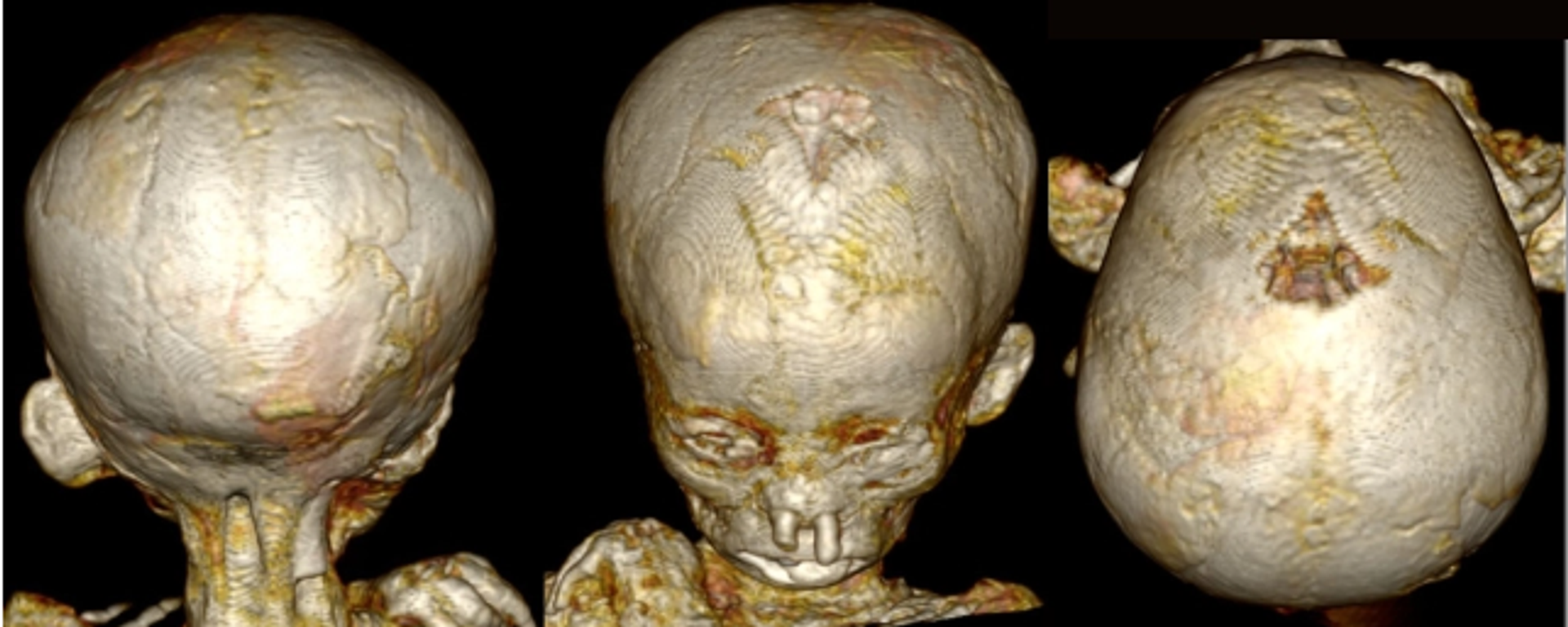 Reconstrucción 3D del cráneo de uno de los niños - Sputnik Mundo, 1920, 29.04.2023