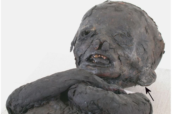 Vista frontal de la momia con indicios de anemia.  - Sputnik Mundo