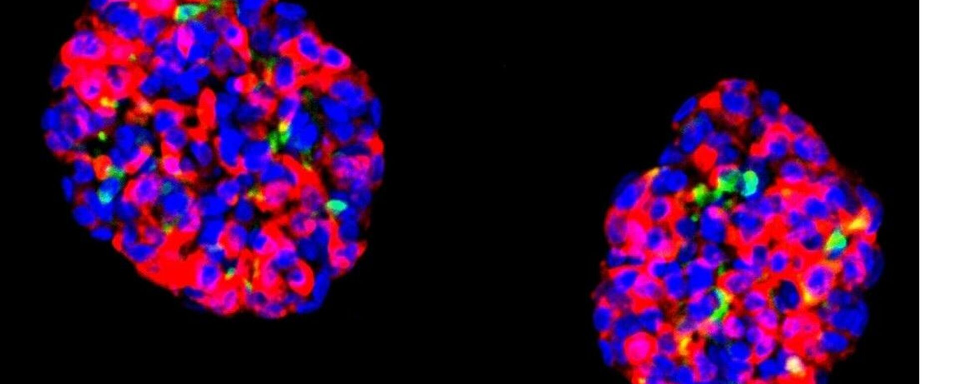 Organoides gástrico humanos - Sputnik Mundo, 1920, 04.06.2023