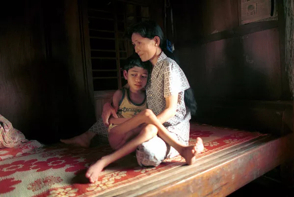 Durante 10 años, las FFAA estadounidense rociaron unos 80 millones de litros de Agente Naranja en territorio vietnamita.En la foto: otra víctima del Agente Naranja. Pham Quoc Huy, de 12 años, en brazos de su madre en su casa situada en el pueblo de Dong Son, en el centro de Vietnam, 2000. Durante 10 años, las FFAA estadounidense rociaron unos 80 millones de litros de Agente Naranja en territorio vietnamita.En la foto: otra víctima del Agente Naranja. Pham Quoc Huy, de 12 años, en brazos de su madre en su casa situada en el pueblo de Dong Son, en el centro de Vietnam, 2000. - Sputnik Mundo
