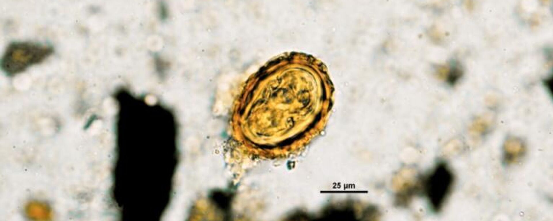 Huevo de Ascaris lumbricoides. Huevo de Ascaris lumbricoides. - Sputnik Mundo, 1920, 29.08.2023