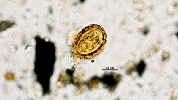 Huevo de Ascaris lumbricoides. - Sputnik Mundo