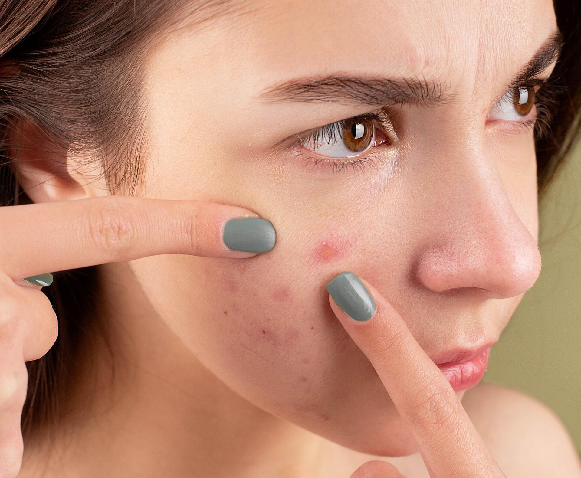 Vitaminas para la piel  - Sputnik Mundo, 1920, 15.09.2023