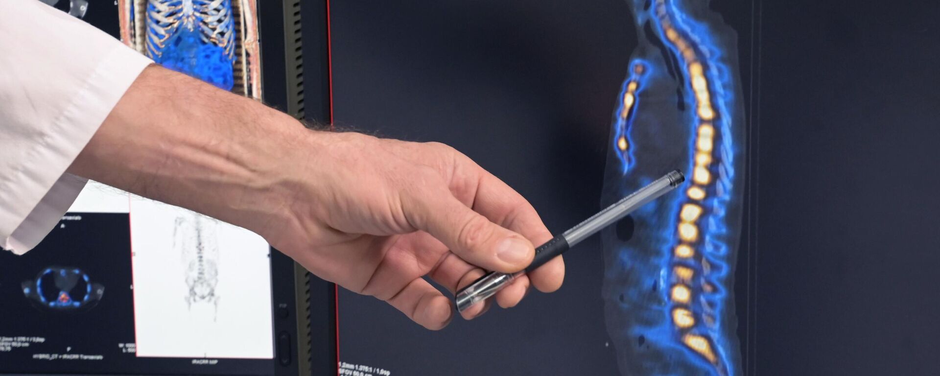 Diagnóstico de patologías de la columna vertebral - Sputnik Mundo, 1920, 29.09.2023